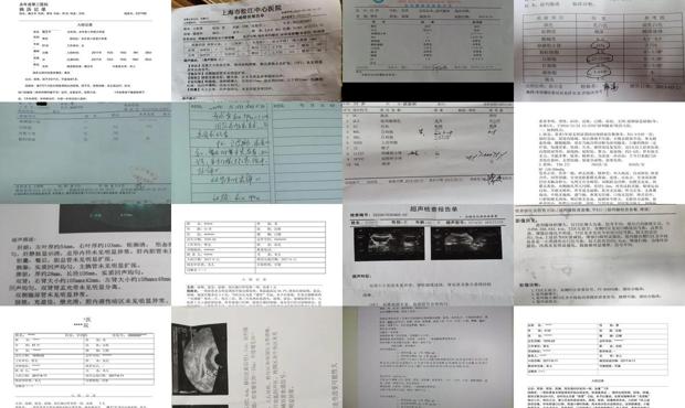 普宁前列腺炎 - 汕头前列腺炎症状病例